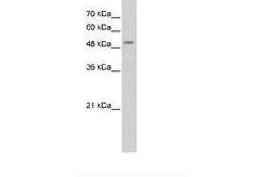 Image no. 2 for anti-serine/threonine Kinase 11 (STK11) (AA 71-120) antibody (ABIN203483) (LKB1 anticorps  (AA 71-120))