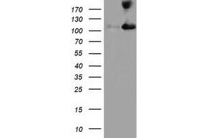 Western Blotting (WB) image for anti-Microtubule Associated Monoxygenase, Calponin and LIM Domain Containing 1 (MICAL1) antibody (ABIN1499467) (MICAL1 anticorps)