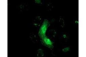 Anti-MRAS mouse monoclonal antibody (ABIN2454547) immunofluorescent staining of COS7 cells transiently transfected by pCMV6-ENTRY MRAS (RC212259). (MRAS anticorps)