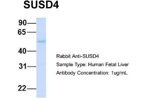Host:  Rabbit  Target Name:  SUSD4  Sample Type:  Human Fetal Liver  Antibody Dilution:  1. (SUSD4 anticorps  (N-Term))