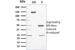 SDS-PAGE Analysis Purified Cytochrome P450 1A1/1A2 Mouse Monoclonal Antibody (P6). (CYP3A1 anticorps)