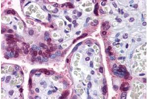 Human Placenta: Formalin-Fixed, Paraffin-Embedded (FFPE)