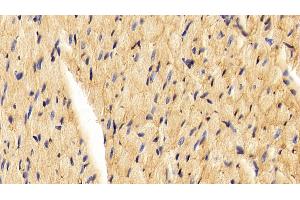 Detection of CAV1 in Rat Cardiac Muscle Tissue using Polyclonal Antibody to Caveolin 1 (CAV1) (Caveolin-1 anticorps  (AA 2-105))