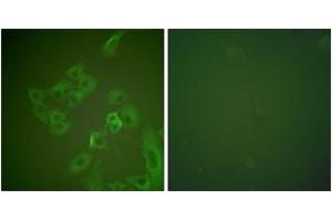Immunofluorescence analysis of A549 cells, using Synuclein beta Antibody. (beta Synuclein anticorps  (AA 85-134))