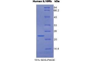 SDS-PAGE analysis of Human IL10Rb Protein. (IL10RB Protéine)