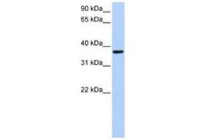 Image no. 1 for anti-High Mobility Group 20B (HMG20B) (AA 201-250) antibody (ABIN6742602) (HMG20B anticorps  (AA 201-250))