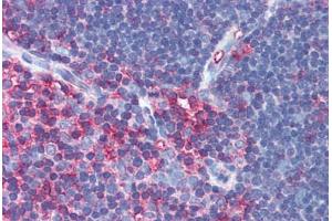 Anti-MSN / Moesin antibody IHC of human thymus. (Moesin anticorps)