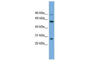 IMPDH2 antibody used at 1 ug/ml to detect target protein. (IMPDH2 anticorps)