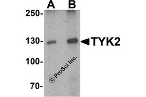 Western Blotting (WB) image for anti-Tyrosine Kinase 2 (TYK2) (N-Term) antibody (ABIN1077422) (TYK2 anticorps  (N-Term))