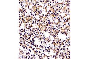 (ABIN654625 and ABIN2844322) staining D11b in human tonsil tissue sections by Immunohistochemistry (IHC-P - paraformaldehyde-fixed, paraffin-embedded sections).
