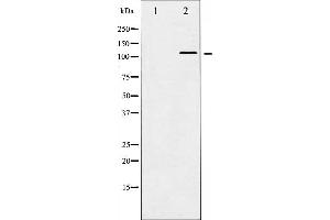 Western blot analysis of HDAC5 phosphorylation expression in NIH-3T3 whole cell lysates,The lane on the left is treated with the antigen-specific peptide.
