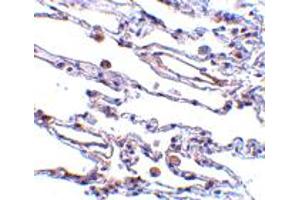 Immunohistochemistry of TRAF3IP2 in human lung tissue with TRAF3IP2 polyclonal antibody  at 5 ug/mL . (TRAF3IP2 anticorps  (AA 554-568))