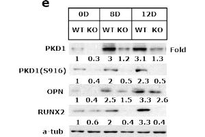 PKD1 contributed to osteoblastic development.
