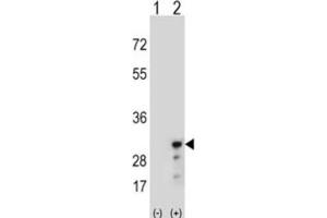 Western Blotting (WB) image for anti-Peroxiredoxin 3 (PRDX3) antibody (ABIN3001722) (Peroxiredoxin 3 anticorps)
