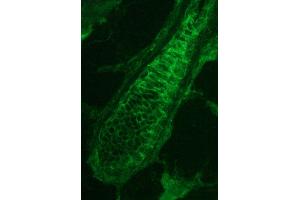 anti-Plakophilin 3 (PKP3) antibody