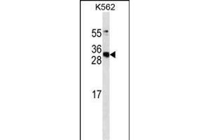 CS antibody ABIN658915 western blot analysis in K562 cell line lysates (35 μg/lane). (APCS anticorps)