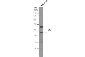 WB Image Rat tissue extract (50 μg) was separated by 10% SDS-PAGE, and the membrane was blotted with ST2 antibody [N1C1] , diluted at 1:500. (IL1RL1 anticorps)