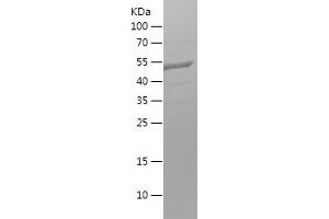 Western Blotting (WB) image for Adaptor-Related Protein Complex 2, alpha 1 Subunit (AP2A1) (AA 601-747) protein (His-IF2DI Tag) (ABIN7121699)