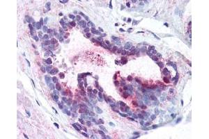 Image no. 1 for anti-Programmed Cell Death 4 (PDCD4) (pSer457), (Ser457) antibody (ABIN401369) (PDCD4 anticorps  (pSer457, Ser457))