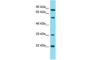 Western Blotting (WB) image for anti-Guanylate Cyclase 1, Soluble, alpha 2 (GUCY1A2) (N-Term) antibody (ABIN2791570) (GUCY1A2 anticorps  (N-Term))