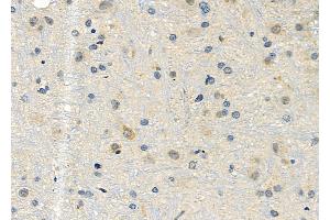 ABIN6257219 and ABIN6276016 at 1/100 staining Rat brain tissue by IHC-P.