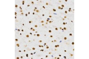 Immunohistochemistry of paraffin-embedded rat brain using DiMethyl-Histone H3-K9 antibody.