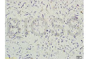 Formalin-fixed and paraffin embedded rat small intestine tissue labeled with Rabbit Anti-gremlin Polyclonal Antibody (ABIN687082) at 1:200 followed by conjugation to the secondary antibody and DAB staining. (GREM1 anticorps  (AA 101-184))