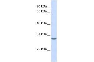 Tetraspanin 6 antibody used at 1 ug/ml to detect target protein. (Tetraspanin 6 anticorps  (N-Term))