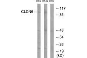 Western blot analysis of extracts from COS7/HT-29 cells, using CLCN6 Antibody. (CLCN6 anticorps  (AA 611-660))