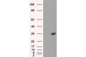 Image no. 9 for anti-Fc gamma RII (CD32) antibody (ABIN1497254) (Fc gamma RII (CD32) anticorps)
