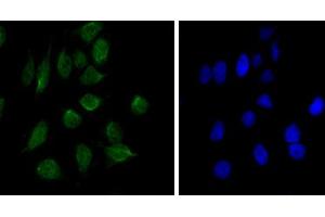 Immunofluorescence analysis of Hela cells using CHD3 mouse mAb (green). (CHD3 anticorps)
