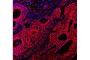 IF analysis of VAPA using anti-VAPA antibody (ABIN7603249). (VAPA anticorps  (N-Term))