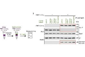 High levels of FNIPs make renal tumours sensitive to Hsp90 inhibitor GB.
