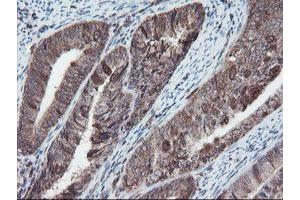 Image no. 3 for anti-SKI-Like Oncogene (SKIL) (AA 307-684) antibody (ABIN1491380)