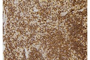 ABIN6277712 at 1/100 staining Rat spleen tissue by IHC-P. (TP53BP1 anticorps  (N-Term))