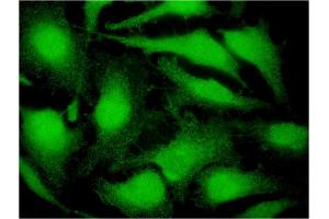 Immunofluorescence of monoclonal antibody to CITED4 on HeLa cell.