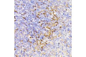 Immunohistochemistry of paraffin-embedded mouse spleen using PSMG1 antibody (ABIN7269593) at dilution of 1:100 (40x lens).