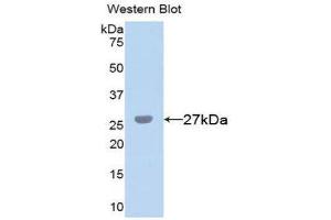 Western Blotting (WB) image for anti-Chitinase 3-Like 1 (Cartilage Glycoprotein-39) (CHI3L1) (AA 112-377) antibody (FITC) (ABIN1859043)