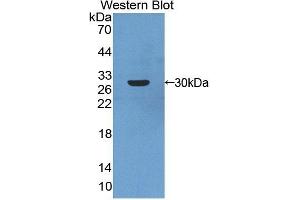 Detection of Recombinant ARNT2, Human using Polyclonal Antibody to Aryl Hydrocarbon Receptor Nuclear Translocator 2 (ARNT2) (ARNT2 anticorps  (AA 1-209))