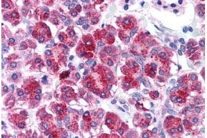 Human Pancreas (formalin-fixed, paraffin-embedded) stained with TLR3 antibody ABIN214574 at 5 ug/ml followed by biotinylated goat anti-rabbit IgG secondary antibody ABIN481713, alkaline phosphatase-streptavidin and chromogen. (TLR3 anticorps  (N-Term))