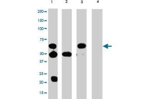 Immunoprecipitation (IP) / Western Blot (WB) Analysis of TERF2 in HL-60 cells : (Lane 1) IP with mouse TERF2 monoclonal antibody, clone 4A794. (TRF2 anticorps)