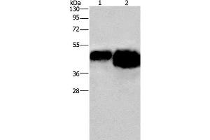 Western Blot analysis of 0. (Ovalbumin anticorps)