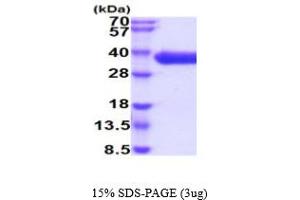 SDS-PAGE (SDS) image for CD84 (CD84) (AA 22-225) protein (His tag) (ABIN5854844)