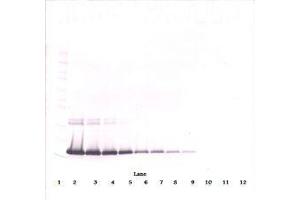 Image no. 1 for anti-Interleukin 2 (IL2) antibody (ABIN465129) (IL-2 anticorps)