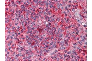 Immunohistochemical analysis of paraffin-embedded human Spleen tissues using anti-ARNTL mouse mAb