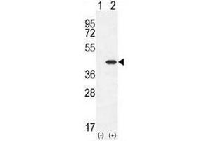 Western blot analysis of CLEC11A (arrow) using rabbit polyclonal CLEC11A Antibody (Center) .