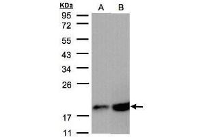 WB Image Sample(30 μg of whole cell lysate) A:A431, B:MOLT4, 12% SDS PAGE antibody diluted at 1:2000