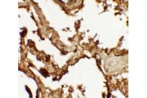 Immunohistochemistry of VKORC1 in human lung tissue with VKORC1 antibody at 2. (VKORC1 anticorps  (N-Term))