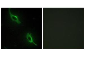 Immunofluorescence analysis of NIH/3T3 cells, using CKMT2 antibody. (CKMT2 anticorps  (Internal Region))