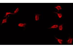 ABIN6272289 staining COLO205 by IF/ICC. (DNAI1 anticorps  (C-Term))